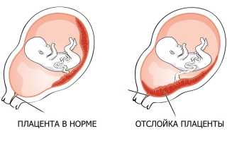 Вред УЗ-исследования для ребенка во время вынашивания