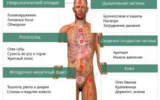 Возможность аллергии на аквариумных рыбок, симптомы аллергической реакции на корм и фильтр аквариума, выбор гипоаллергенного корма