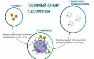 Возможность аллергии на алоэ, причины и симптоматика аллергической реакции, аллергены в столетнике, лечение и профилактика патологии