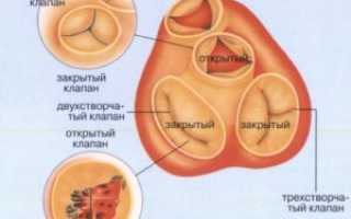Все о приобретенных пороках сердца: виды, симптомы, диагностика и лечение