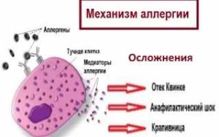 Проявление аллергии на кошек у детей, причины возникновения, методы профилактики