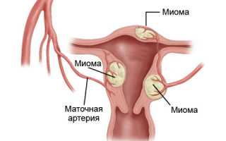 Важность ультразвукового исследования в гинекологии