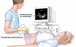 Эхокардиография, УЗИ, ЭхоКГ сердца: показания к проведению и подготовка