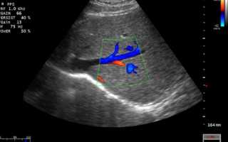 Доплерография шейных артерий и головного мозга