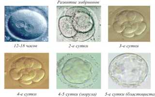 Первая неделя вынашивания: нужно ли выполнять УЗИ