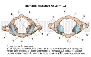 Перелом шеи (шейного отдела позвоночника)