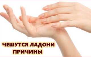 Чешутся ладони: причины и лечение