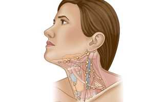 Как проводят УЗ-диагностику шейных лимфатических узлов