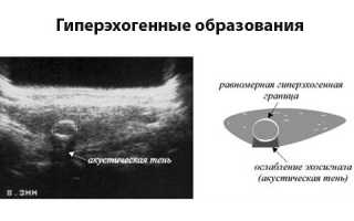 Опасны ли гипоэхогенные образования