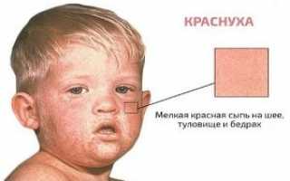 Отличительные черты ветрянки, краснухи и похожей на них аллергии, лечение патологий и борьба с зудом, профилактика заболеваний