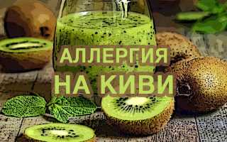 Возможность аллергии на киви у взрослых и детей, аллергены в продукте, симптомы и лечение патологии