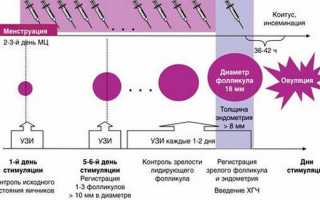 Естественная беременность после ЭКО, возможно ли это?