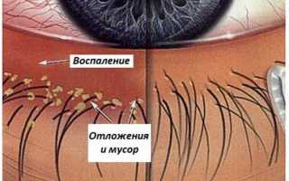 Почему кожа век покраснела шелушится и очень зудит