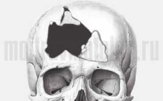 Последствия после перелома свода и основания черепа