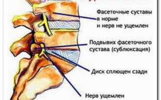 Почему болит в области спины и шеи