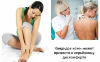 Способы применения препарат Микосист от грибка