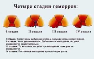 Анальный секс при геморрое