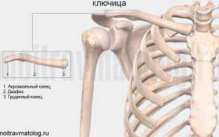 Перелом ключицы