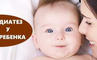 Диатез у ребенка: все, что нужно знать любящим родителям