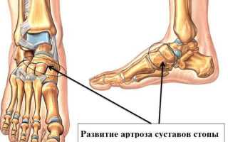 Боль в пятке может о многом рассказать