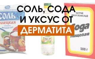 ​  Лечимся от дерматита! Солью? Содой? Уксусом?