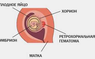 Нужна ли УЗ-диагностика у беременных в 6 недель