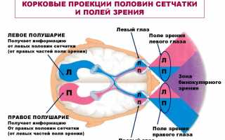 Коррекция дальтонизма или как полностью вылечить патологию